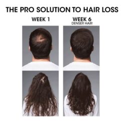 L'Oréal Serie Expert Serioxyl Advanced Densifying Serum 90ml